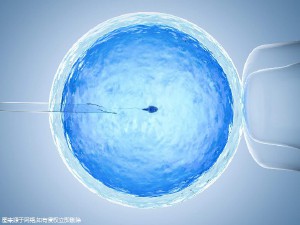生殖妇科